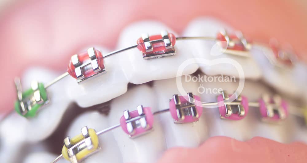 Diş telinin faydaları
